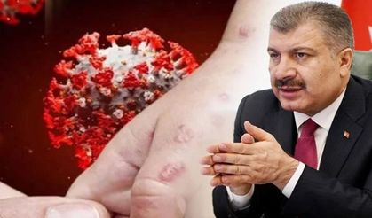 Eris varyantı Türkiye'de